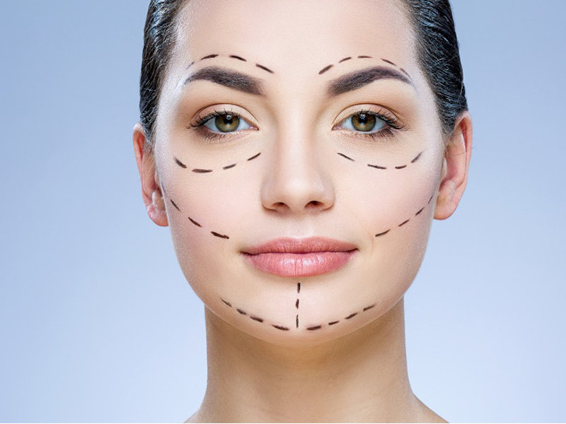 Nên tránh tiêm Botox ở những vị trí nào trên khuôn mặt?