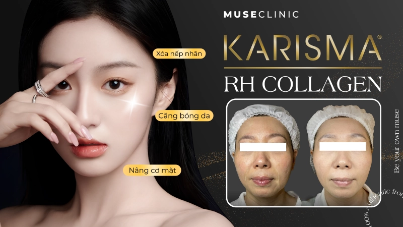 Karisma Rh Collagen – Bí quyết ngăn lão hoá da tự nhiên