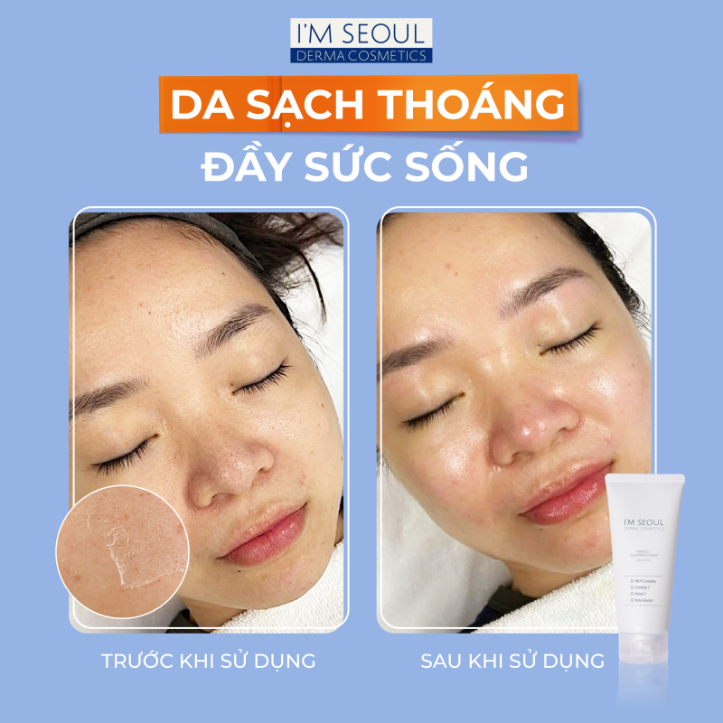 Sữa rửa mặt sạch sâu, dịu nhẹ I'm Seoul Perfect Cleansing Foam