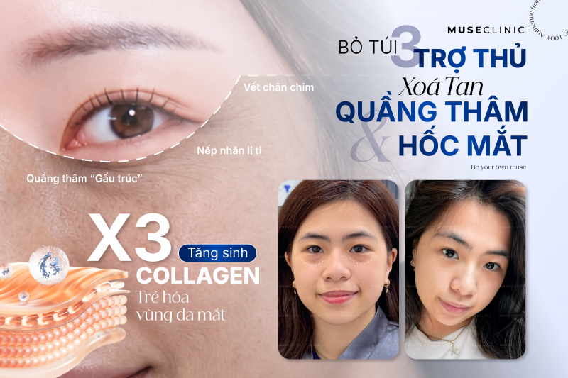 BỘ 3 TRẺ HÓA VÙNG MẮT THẾ HỆ MỚI KHÔNG CẦN PHẪU THUẬT - GIẢI PHÁP CHO ĐÔI MẮT TƯƠI TRẺ TỰ NHIÊN 