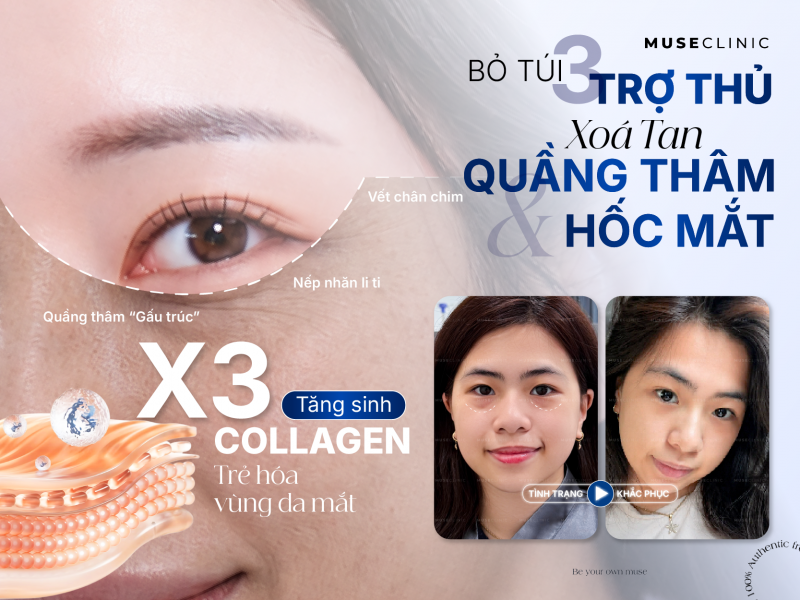BỘ 3 TRẺ HÓA VÙNG MẮT THẾ HỆ MỚI KHÔNG CẦN PHẪU THUẬT - GIẢI PHÁP CHO ĐÔI MẮT TƯƠI TRẺ TỰ NHIÊN 