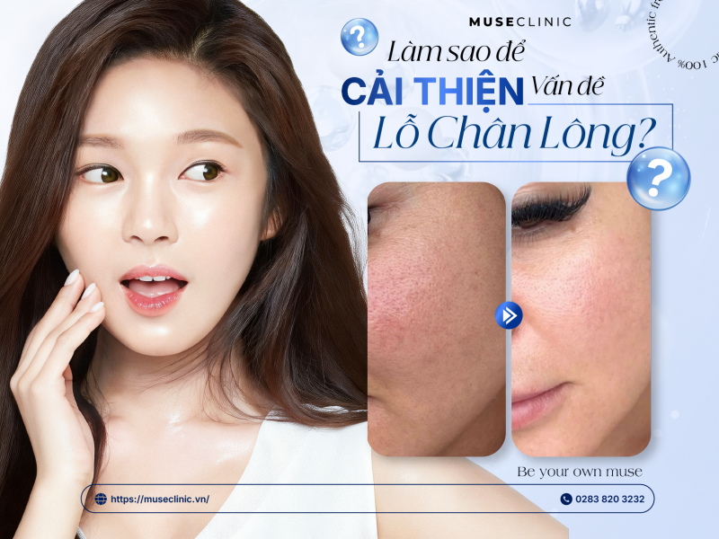 Tại Sao Lỗ Chân Lông Càng Ngày Càng To Và Cách Khắc Phục Hiệu Quả?