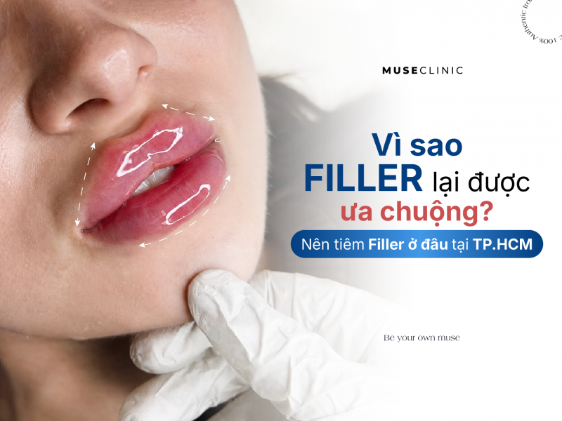 Vì sao Filler lại được ưa chuộng? Nên tiêm Filler ở đâu tại TP.HCM?
