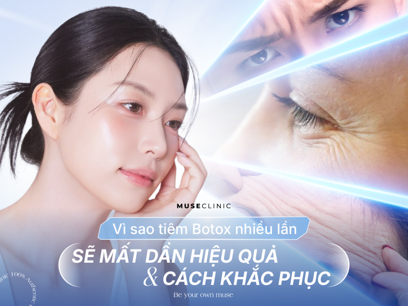 Vì Sao Tiêm Botox Nhiều Lần Không Còn Hiệu Quả Như Trước? Cách Khắc Phục Lờn Botox Từ Chuyên Gia 