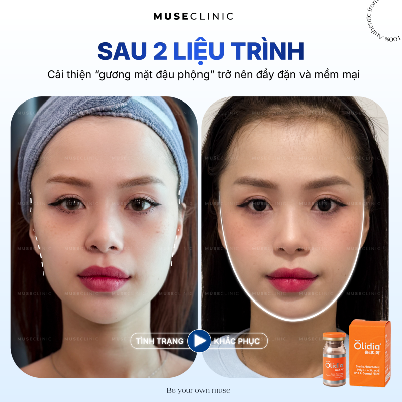 THE MUSE SKINVERSE | MENU LÀM ĐẸP 'HOT' NHẤT THÁNG 8 