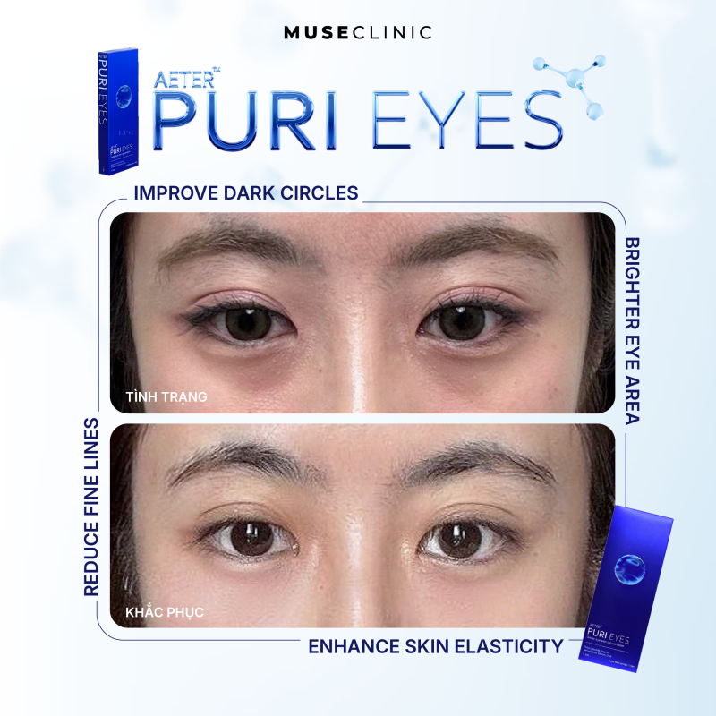 THE MUSE SKINVERSE | MENU LÀM ĐẸP 'HOT' NHẤT THÁNG 8 
