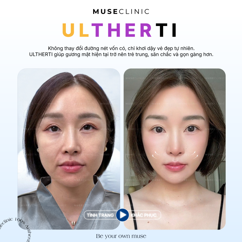 THE MUSE SKINVERSE | MENU LÀM ĐẸP 'HOT' NHẤT THÁNG 8 