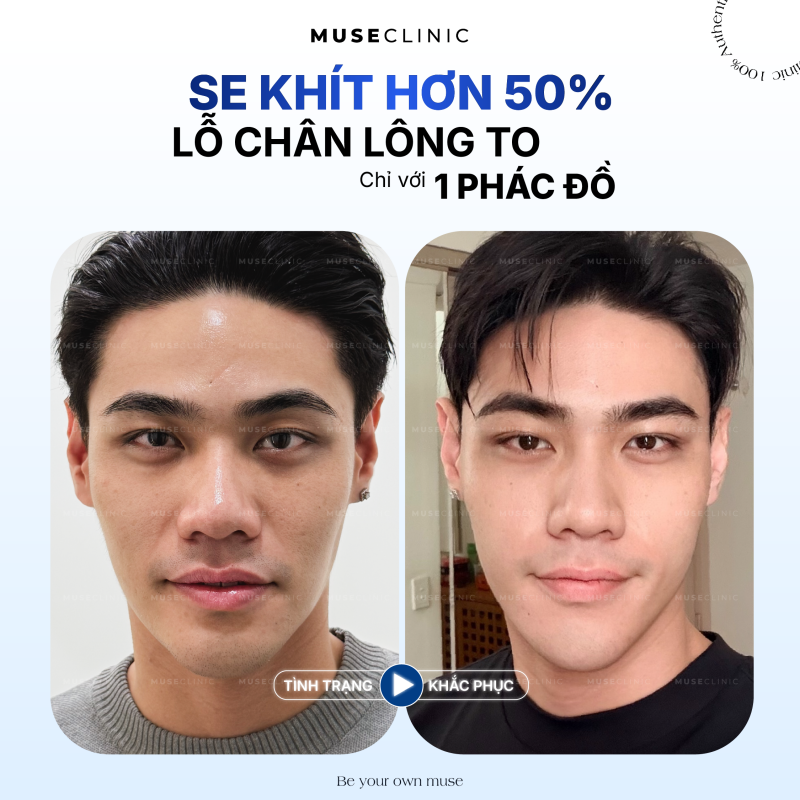 THE MUSE SKINVERSE | MENU LÀM ĐẸP 'HOT' NHẤT THÁNG 8 