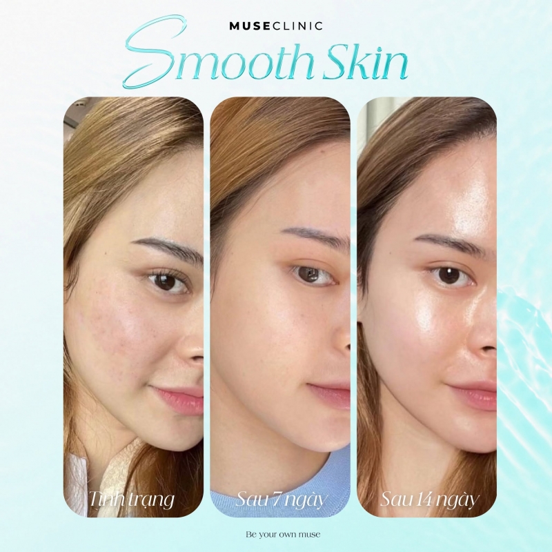 Smooth Skin