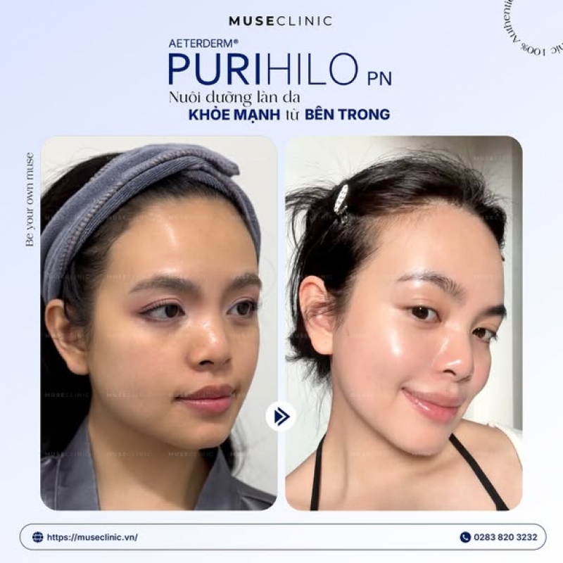  PuriHilo