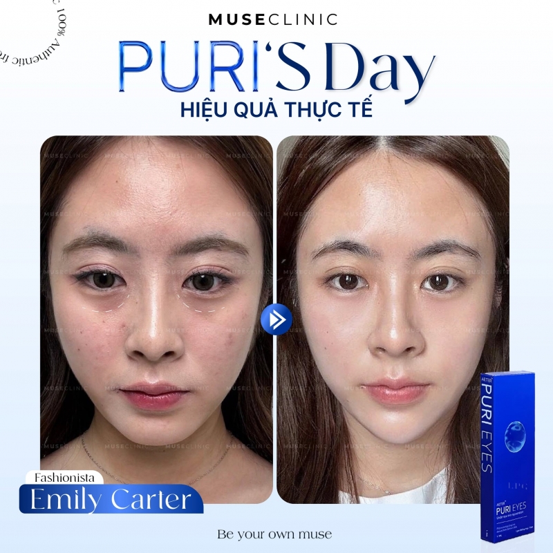 PuriEyes