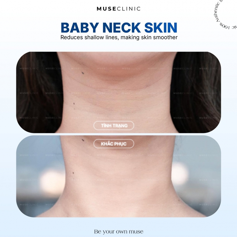 Baby Neck Skin