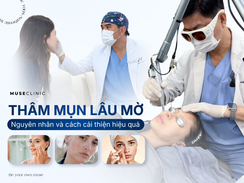 Thâm Mụn Lâu Mờ: Nguyên Nhân Và Cách Cải Thiện Hiệu Quả